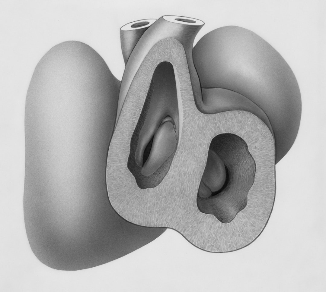 A black and white drawing showing a heart with fluid buildup around it, indicating cardiac tamponade.